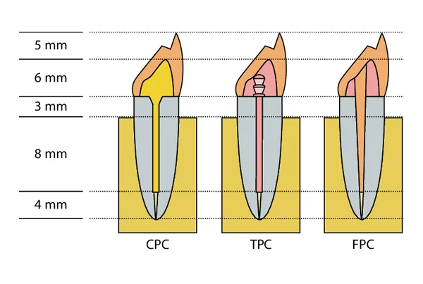 Post n Core